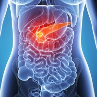 Найден новый фактор риска развития рака поджелудочной железы