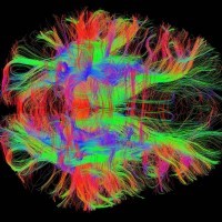 Новый датчик МРТ отображает активность кальция внутри мозга