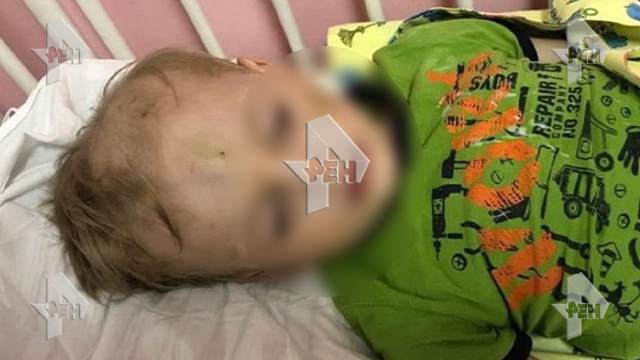 Фото: мать зверски избила и покусала двух малышей в Петербурге