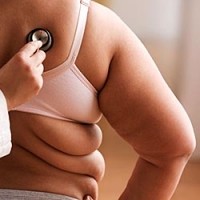 Ожирение - фактор риска развития кардиотоксичности